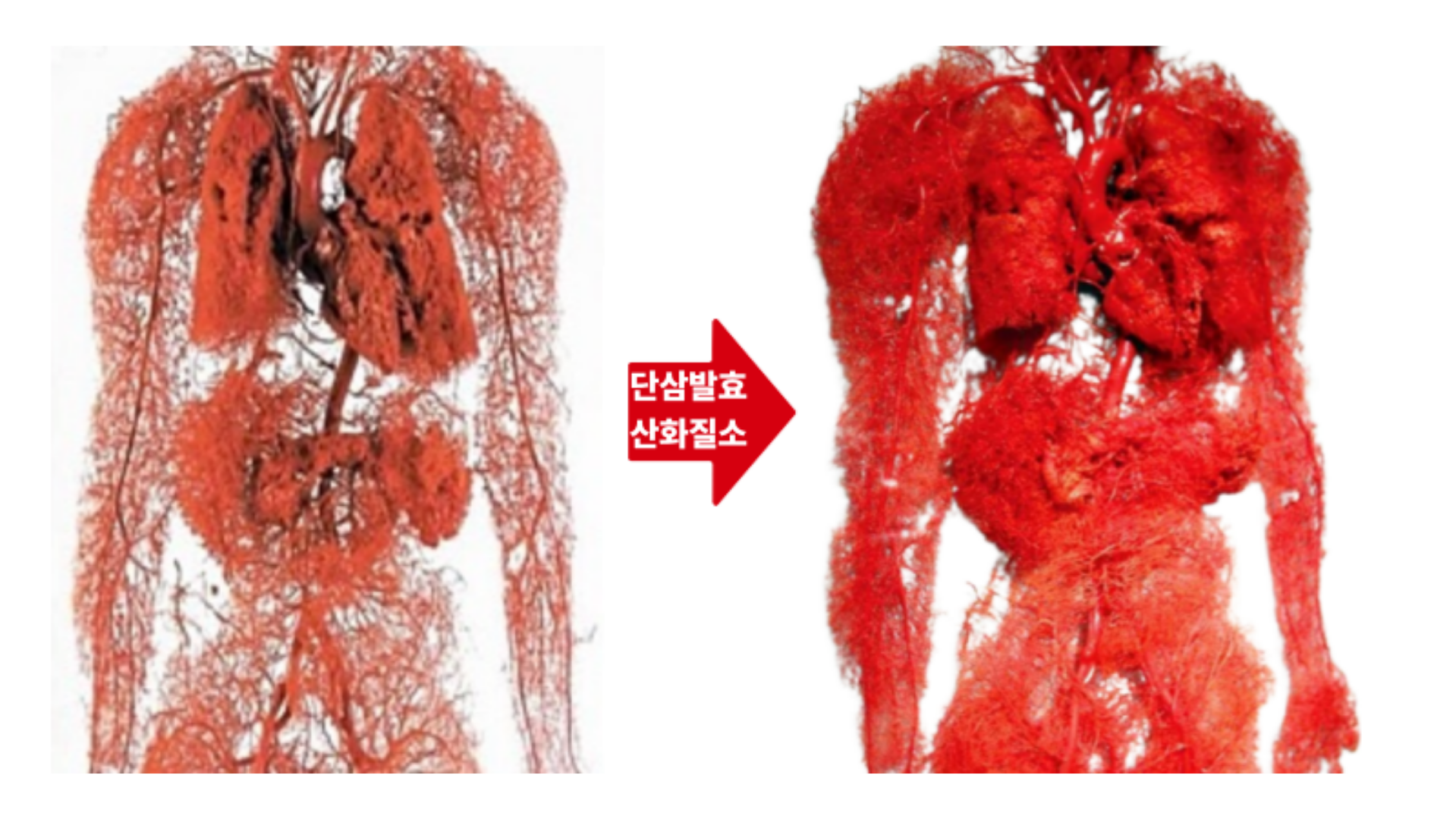 천혈단 혈행 관리 루틴 이미지